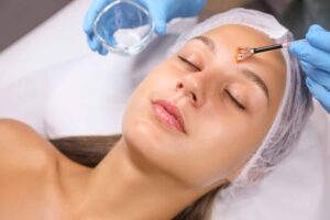para que sirve peeling facial