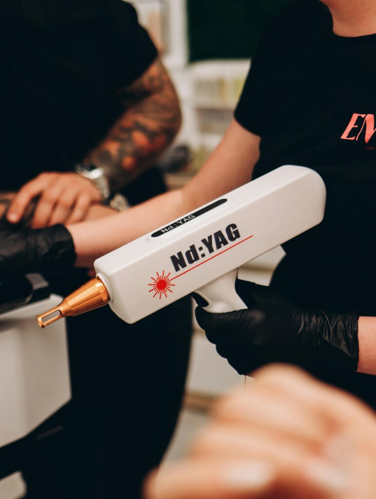 Cómo funciona la eliminación tatuajes con láser